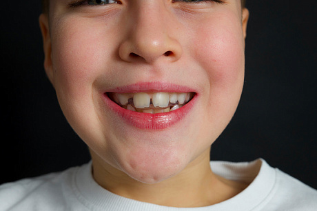 Капы Sky Kids 7-9 лет